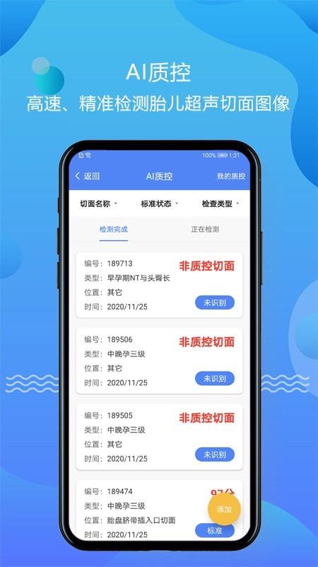超声智库  v1.2.7图2