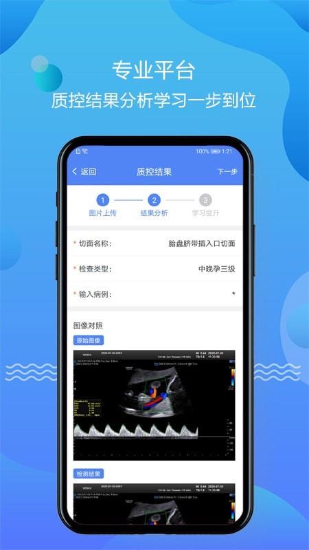 超声智库  v1.2.7图1